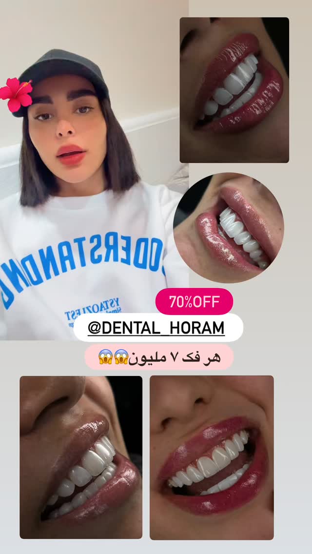  جدید ترین استوری اینستاگرام یگانه مرسلی
