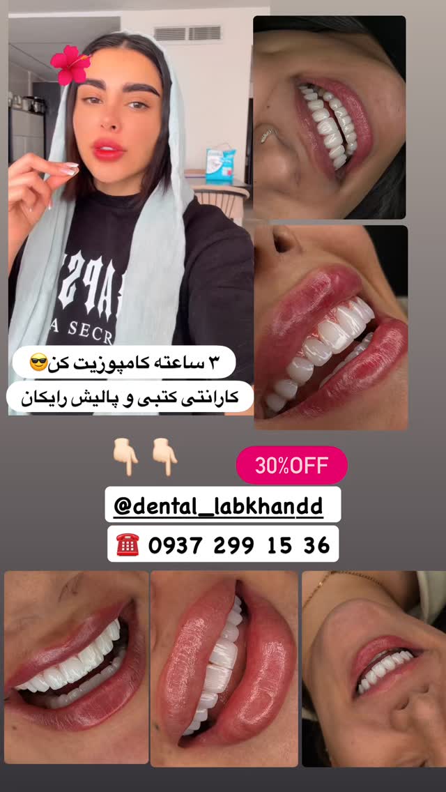  جدید ترین استوری اینستاگرام یگانه مرسلی