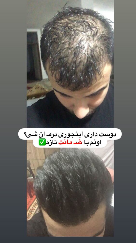  جدید ترین استوری اینستاگرام یگانه مرسلی