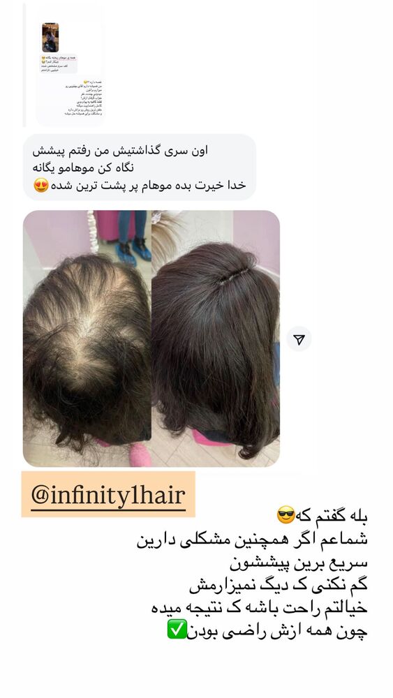  جدید ترین استوری اینستاگرام یگانه مرسلی