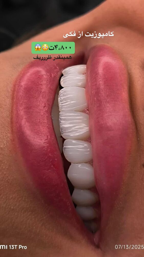  جدید ترین استوری اینستاگرام یگانه مرسلی