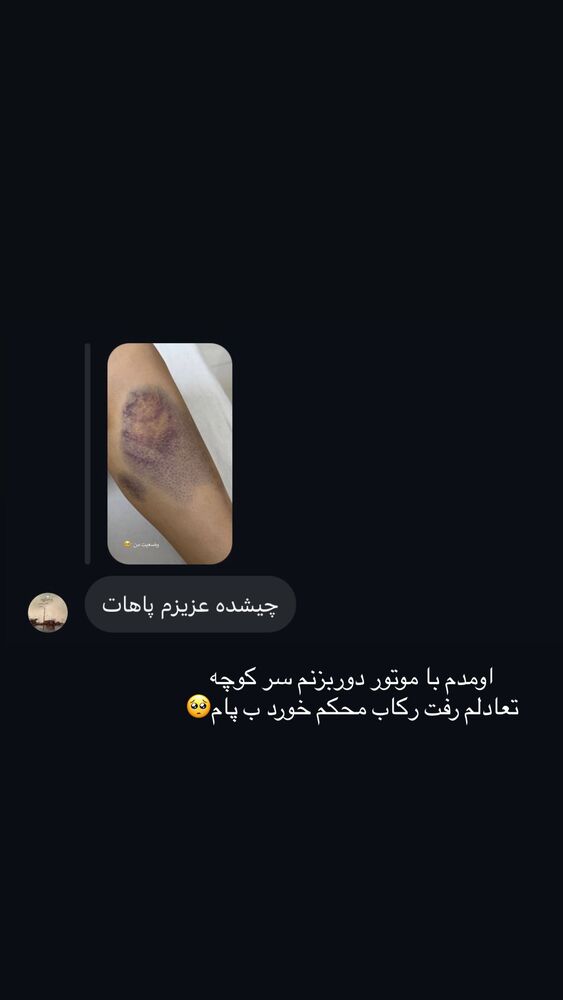  جدید ترین استوری اینستاگرام یگانه مرسلی
