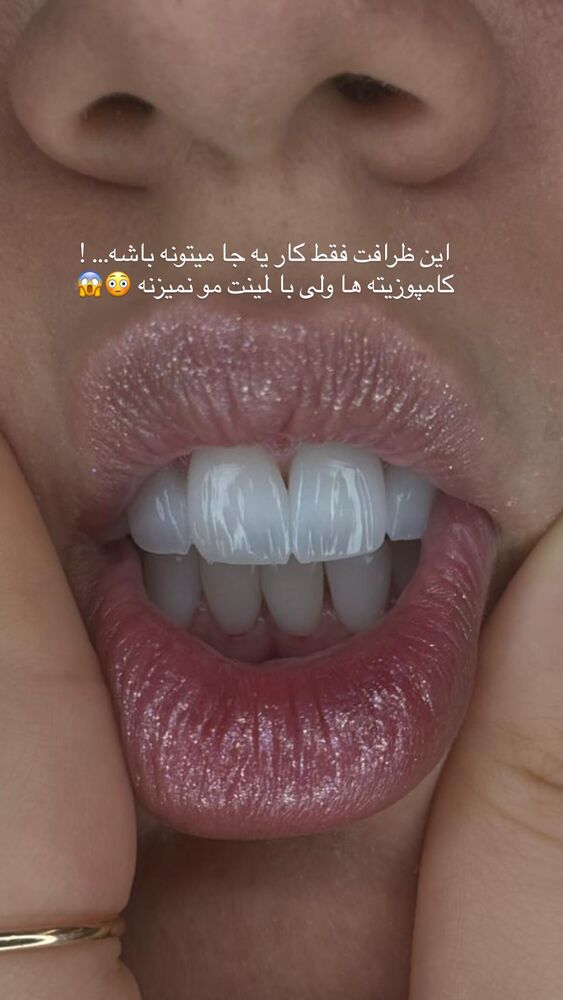  جدید ترین استوری اینستاگرام یگانه مرسلی