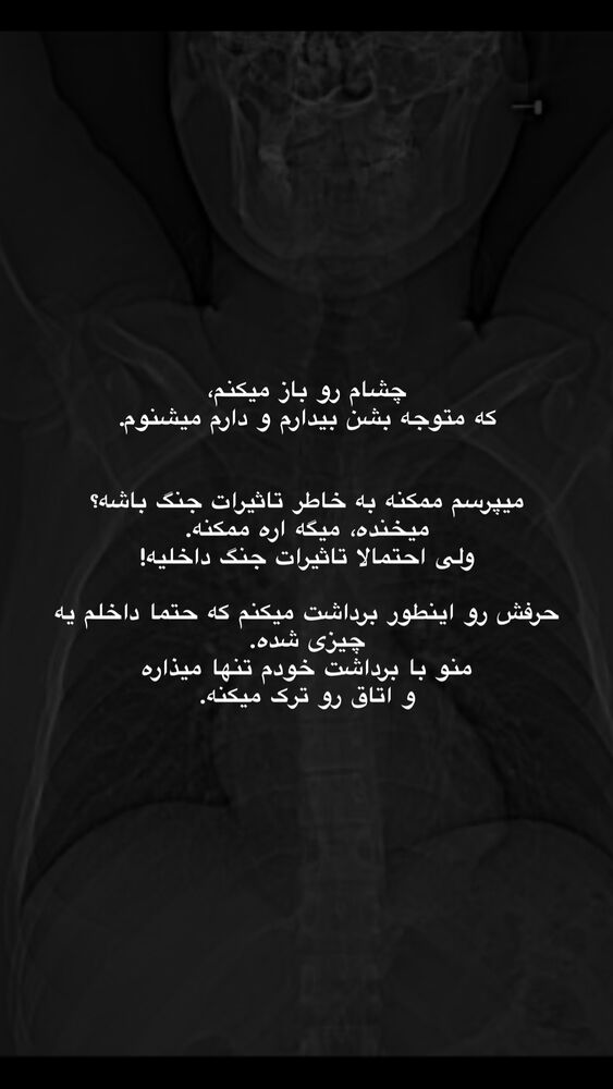  جدید ترین استوری اینستاگرام امیر پارسا نشاط