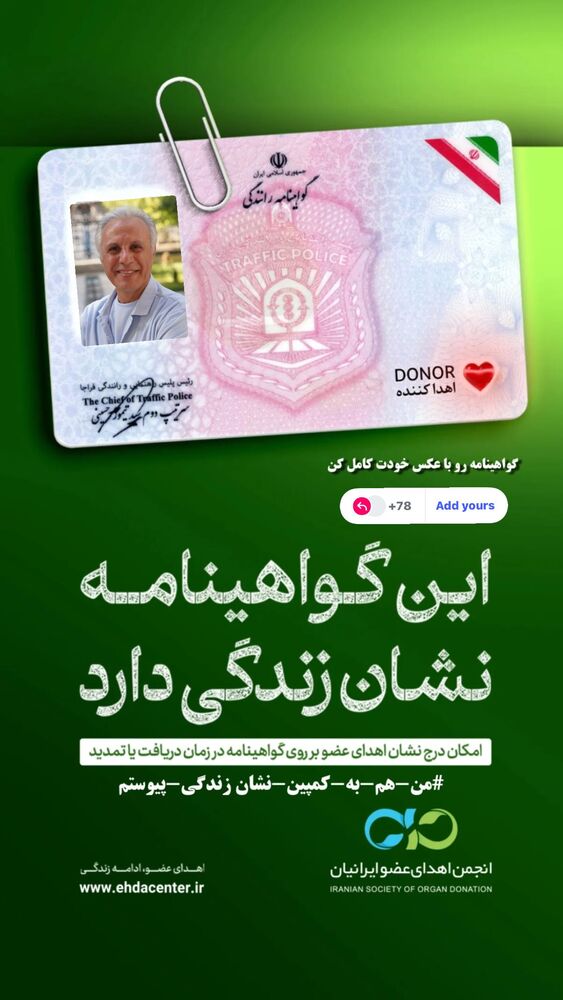  جدید ترین استوری اینستاگرام علی فروتن
