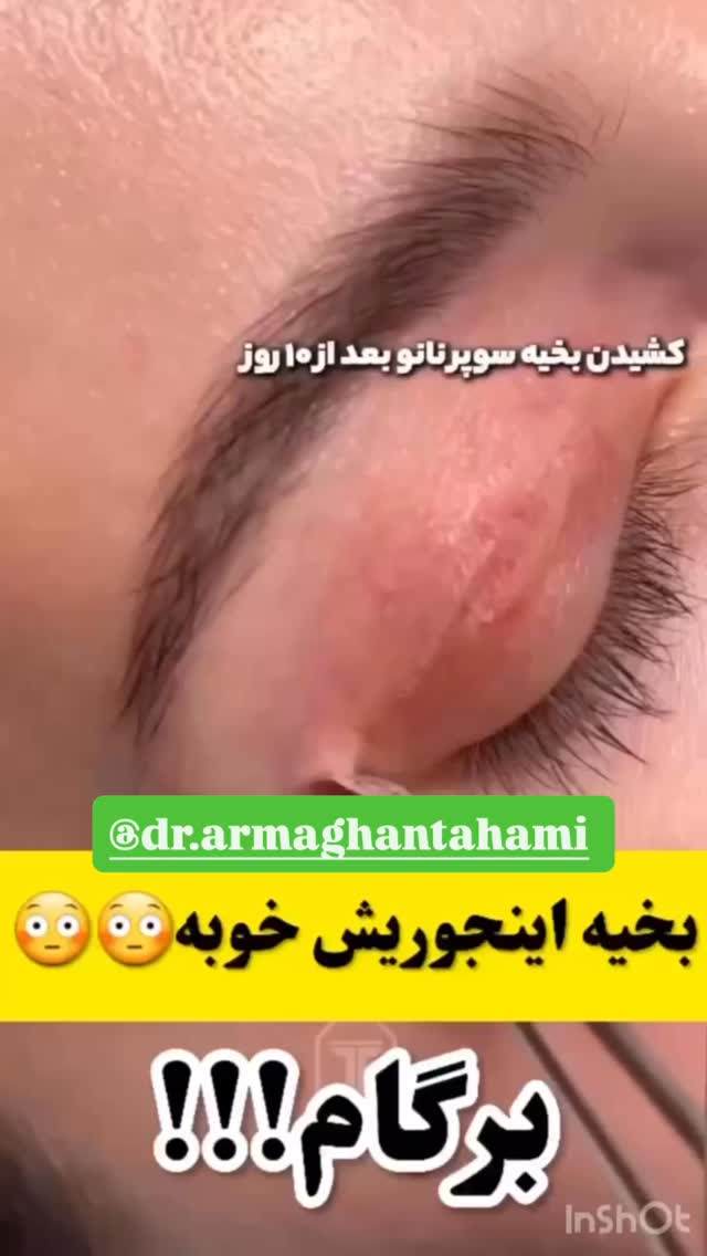  جدید ترین استوری اینستاگرام آناهیتا سلمانی