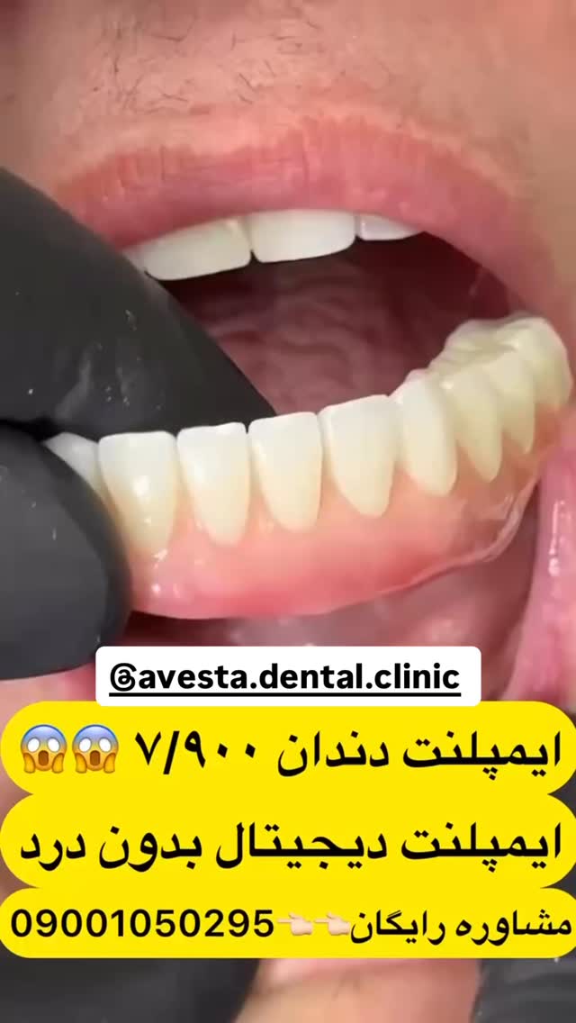  جدید ترین استوری اینستاگرام آناهیتا سلمانی