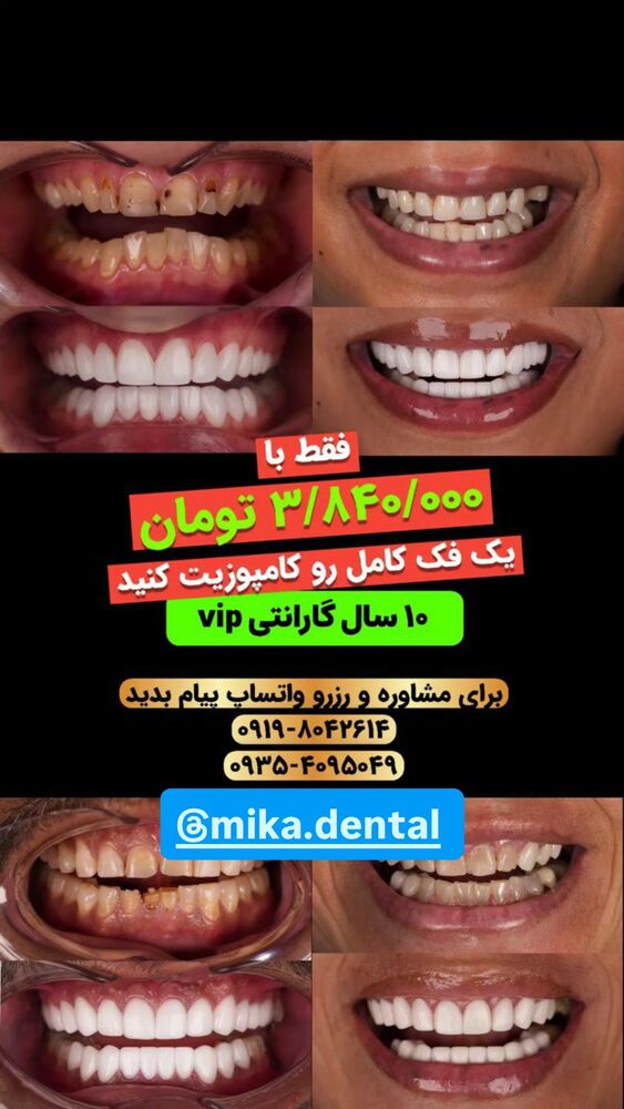  جدید ترین استوری اینستاگرام آناهیتا سلمانی