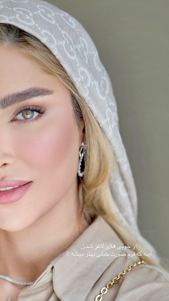  جدید ترین استوری اینستاگرام آناشید حسینی