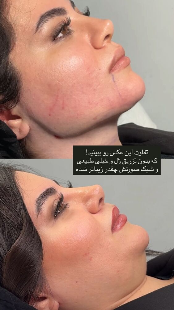  جدید ترین استوری اینستاگرام آناشید حسینی