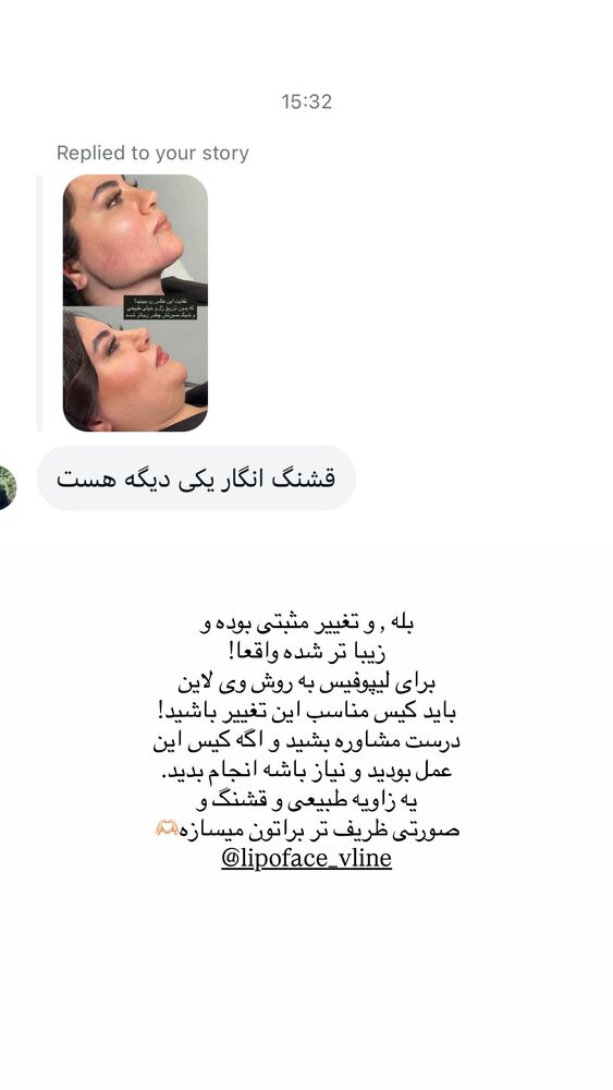  جدید ترین استوری اینستاگرام آناشید حسینی