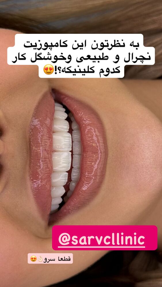  جدید ترین استوری اینستاگرام آرام