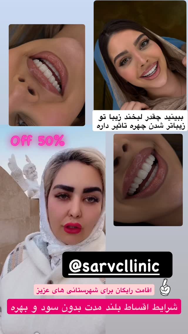  جدید ترین استوری اینستاگرام آرام
