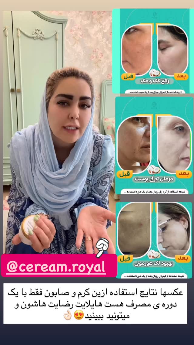  جدید ترین استوری اینستاگرام آرام