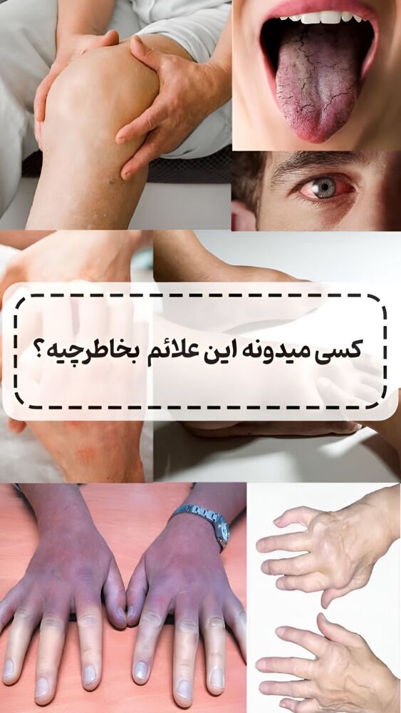  جدید ترین استوری اینستاگرام آرام