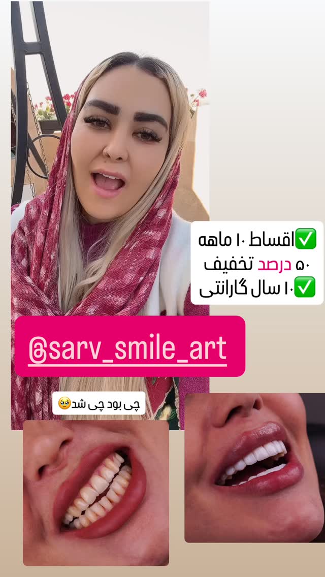  جدید ترین استوری اینستاگرام آرام