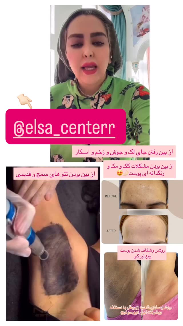  جدید ترین استوری اینستاگرام آرام