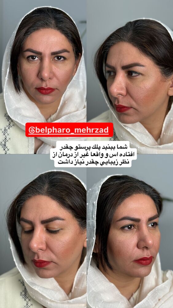  جدید ترین استوری اینستاگرام آرزو ملكوتي راد