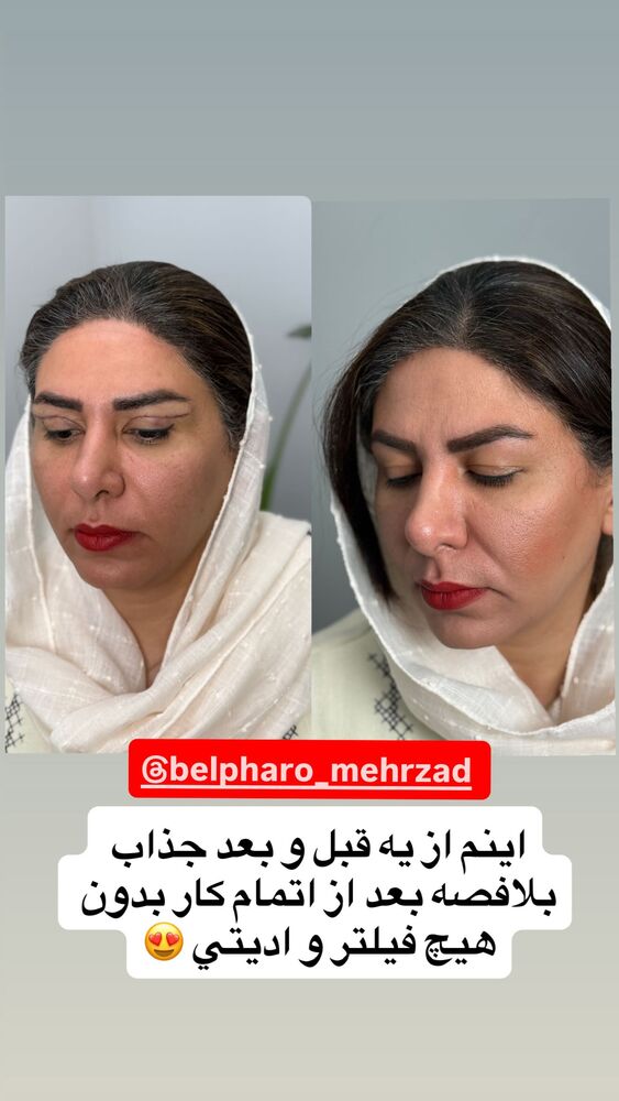  جدید ترین استوری اینستاگرام آرزو ملكوتي راد
