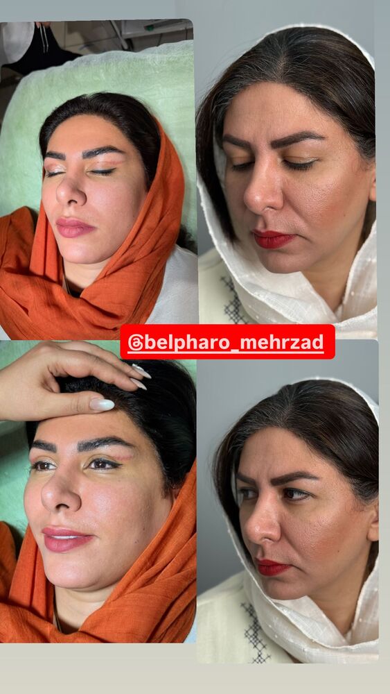  جدید ترین استوری اینستاگرام آرزو ملكوتي راد