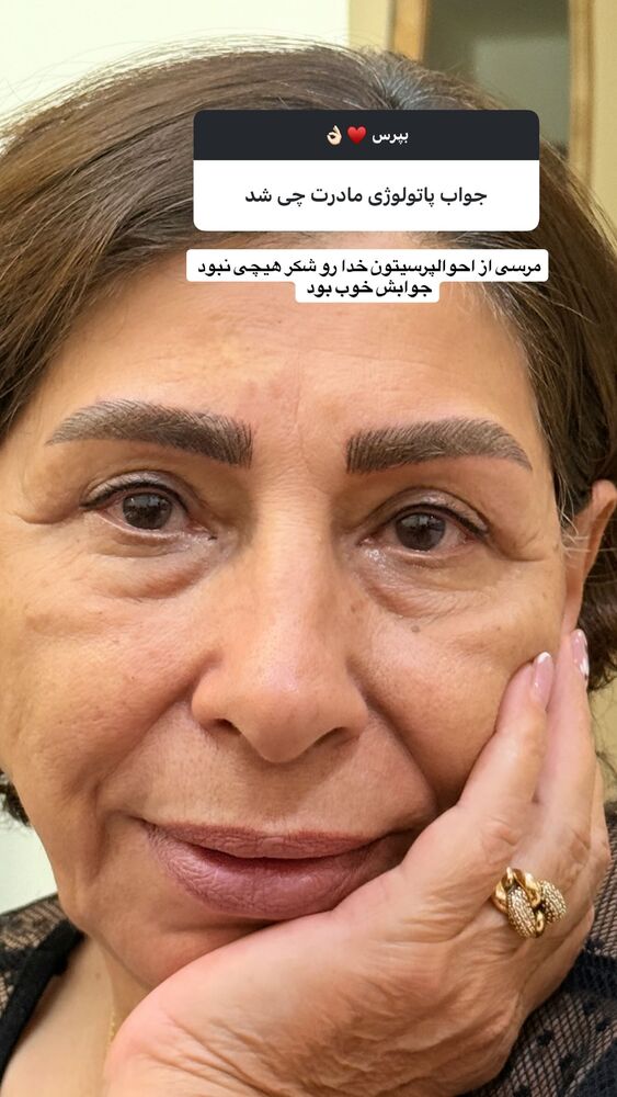  جدید ترین استوری اینستاگرام آرزو ملكوتي راد