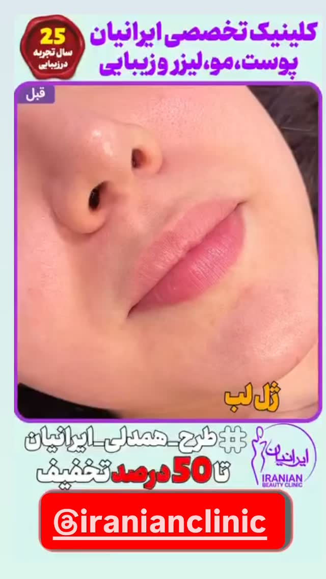  جدید ترین استوری اینستاگرام آرزو ملكوتي راد