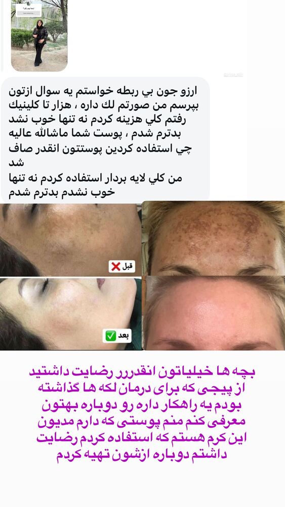  جدید ترین استوری اینستاگرام آرزو ملكوتي راد