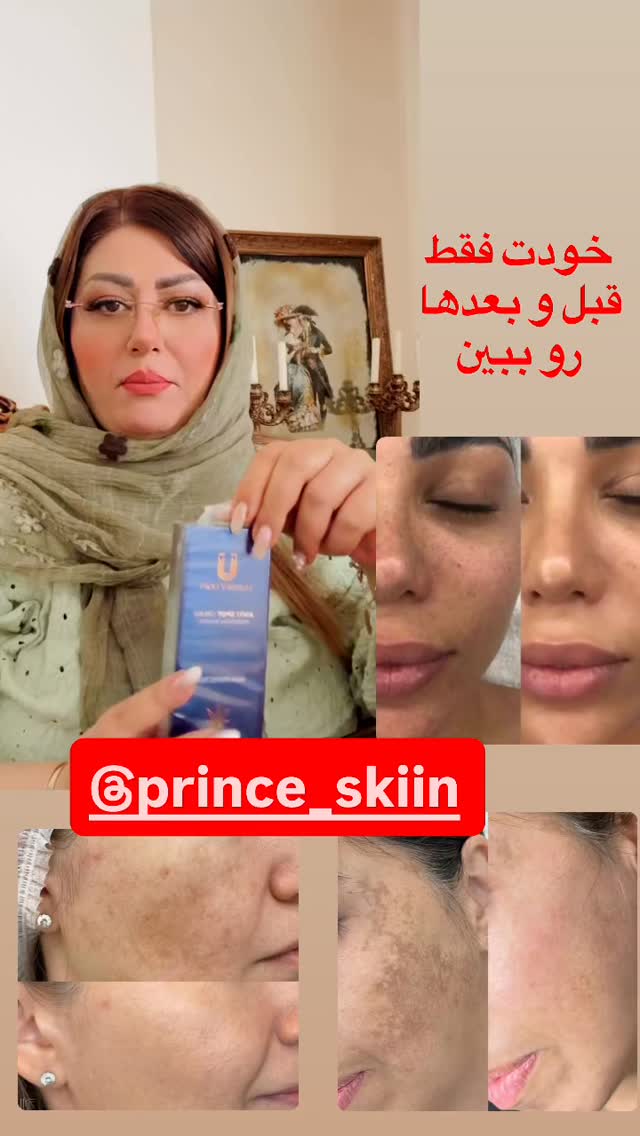  جدید ترین استوری اینستاگرام آرزو ملكوتي راد
