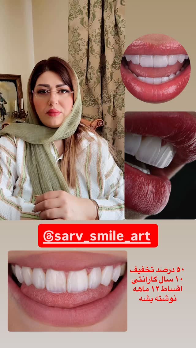  جدید ترین استوری اینستاگرام آرزو ملكوتي راد