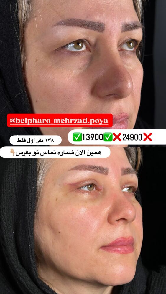  جدید ترین استوری اینستاگرام آرزو ملكوتي راد