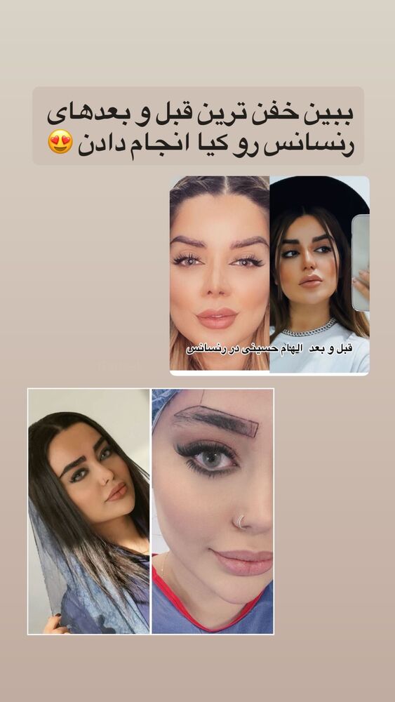  جدید ترین استوری اینستاگرام آرزو ملكوتي راد