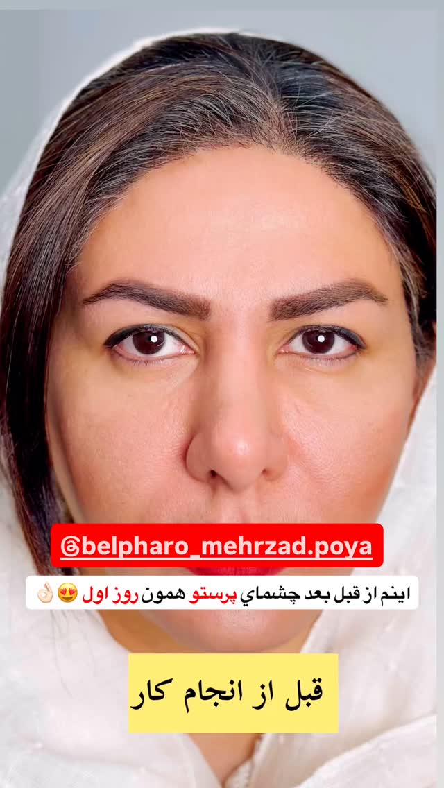  جدید ترین استوری اینستاگرام آرزو ملكوتي راد