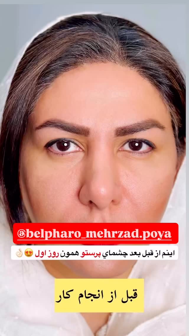  جدید ترین استوری اینستاگرام آرزو ملكوتي راد