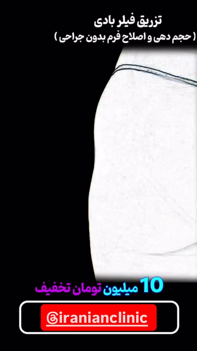  جدید ترین استوری اینستاگرام آرزو ملكوتي راد