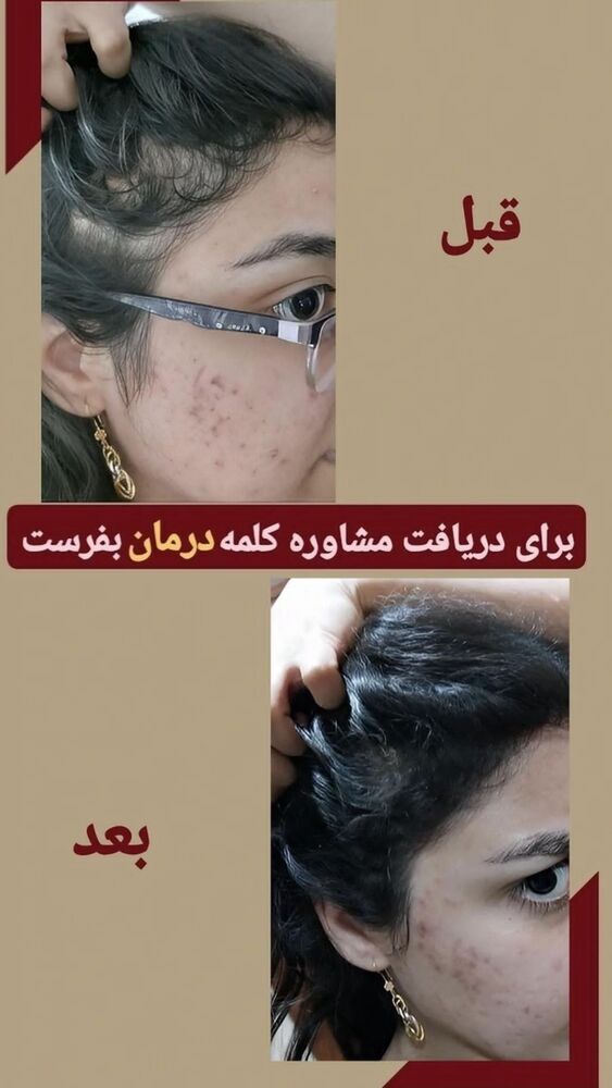  جدید ترین استوری اینستاگرام آرزو ملكوتي راد