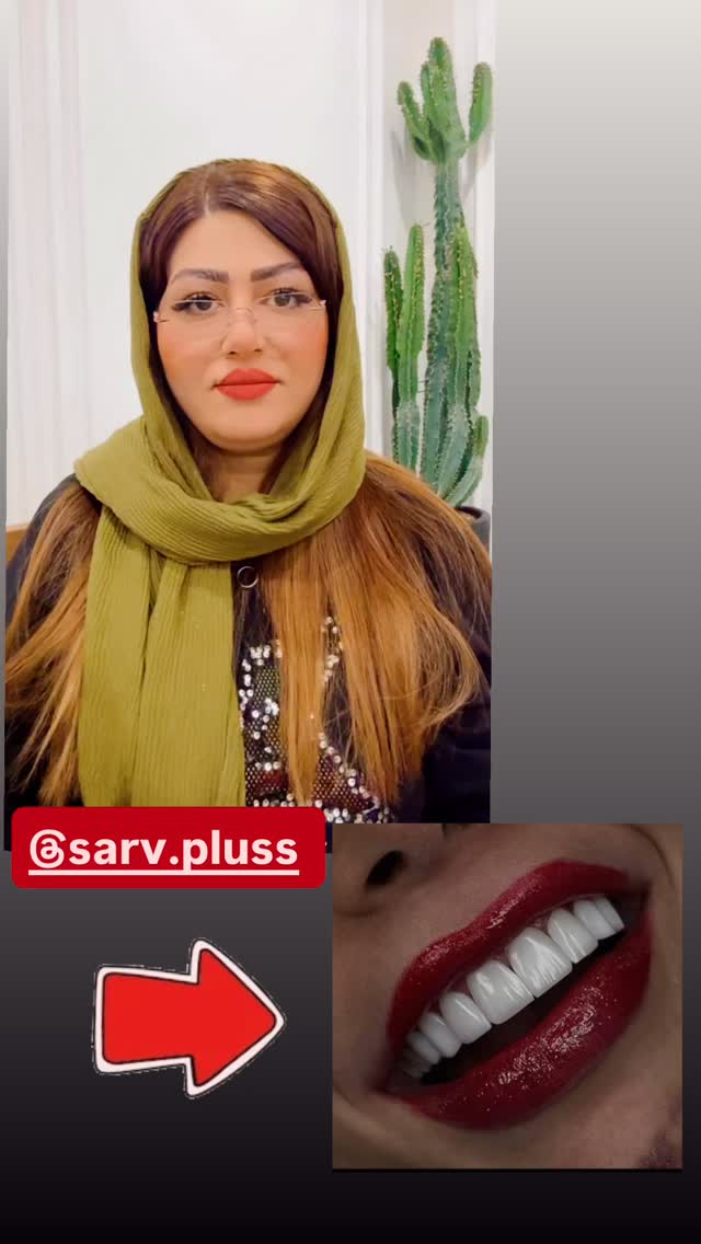  جدید ترین استوری اینستاگرام آرزو ملكوتي راد