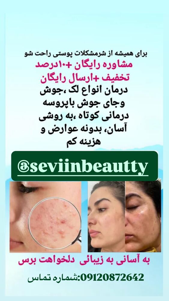  جدید ترین استوری اینستاگرام آرمان میرانی