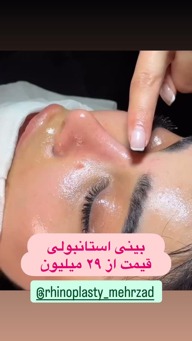  جدید ترین استوری اینستاگرام حبیب اروان