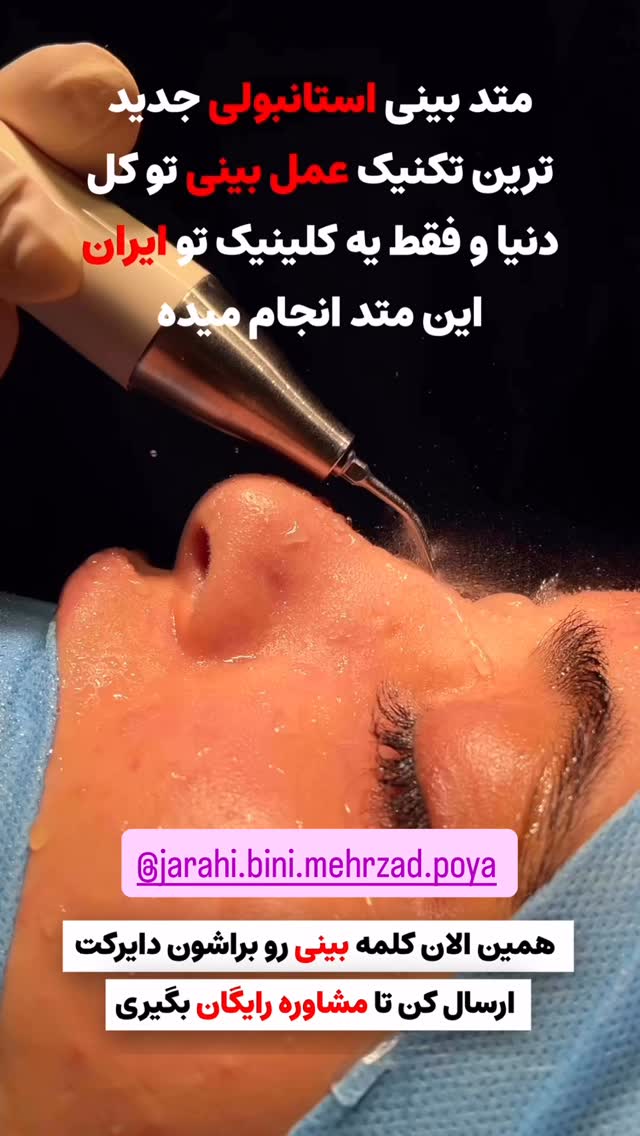  جدید ترین استوری اینستاگرام حبیب اروان