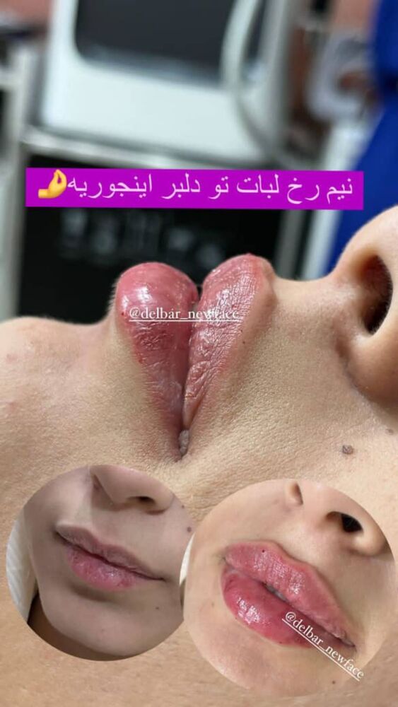  جدید ترین استوری اینستاگرام عسل و محمد