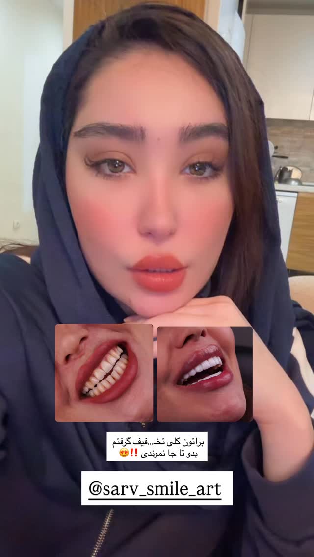  جدید ترین استوری اینستاگرام عسل و محمد