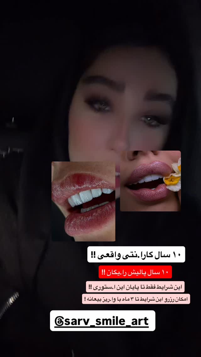  جدید ترین استوری اینستاگرام عسل و محمد