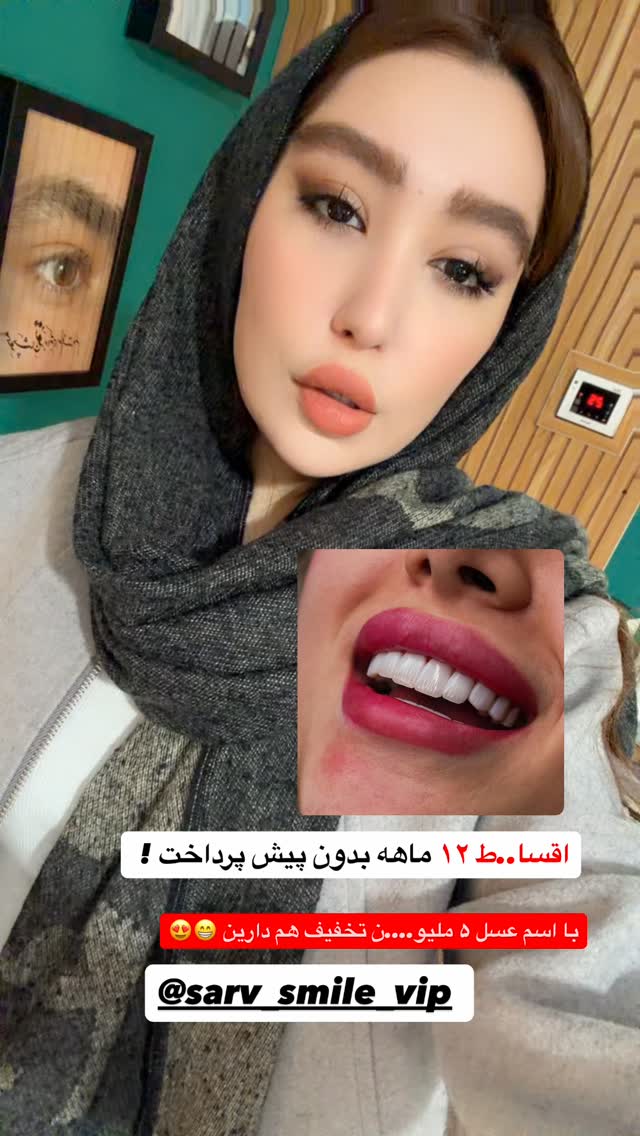  جدید ترین استوری اینستاگرام عسل و محمد