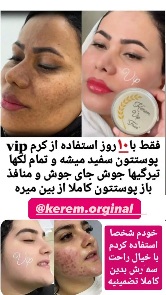  جدید ترین استوری اینستاگرام آیدا و محسن