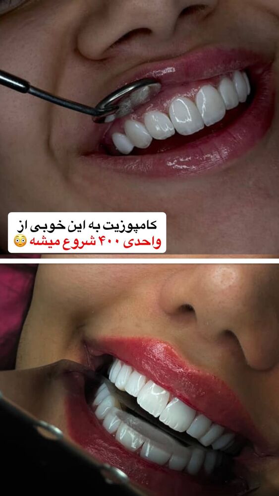  جدید ترین استوری اینستاگرام آیدا و محسن