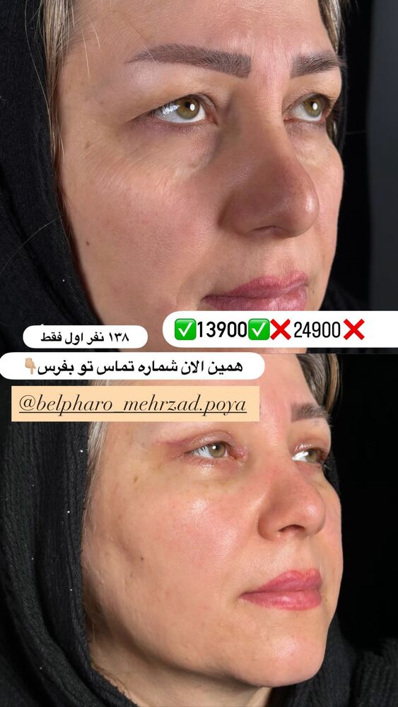  جدید ترین استوری اینستاگرام آیدا و محسن