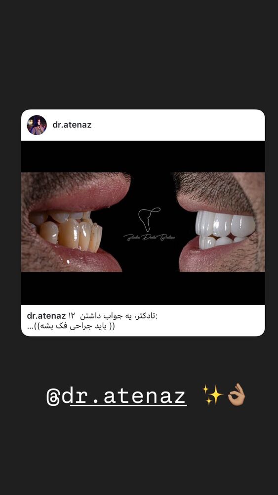  جدید ترین استوری اینستاگرام بهادر عبدی