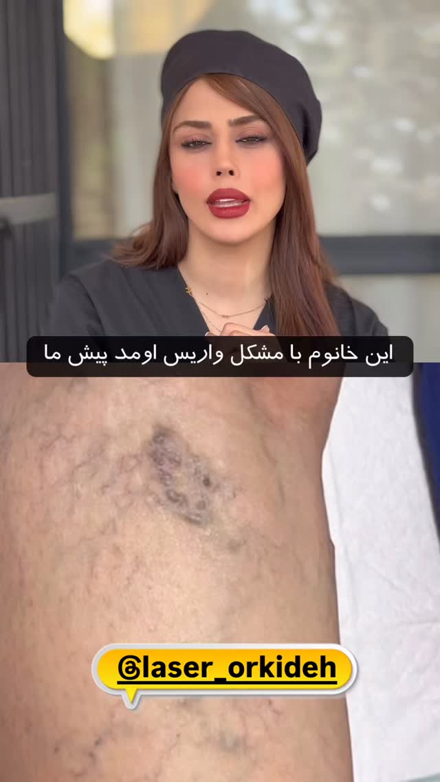  جدید ترین استوری اینستاگرام بانوی خونه