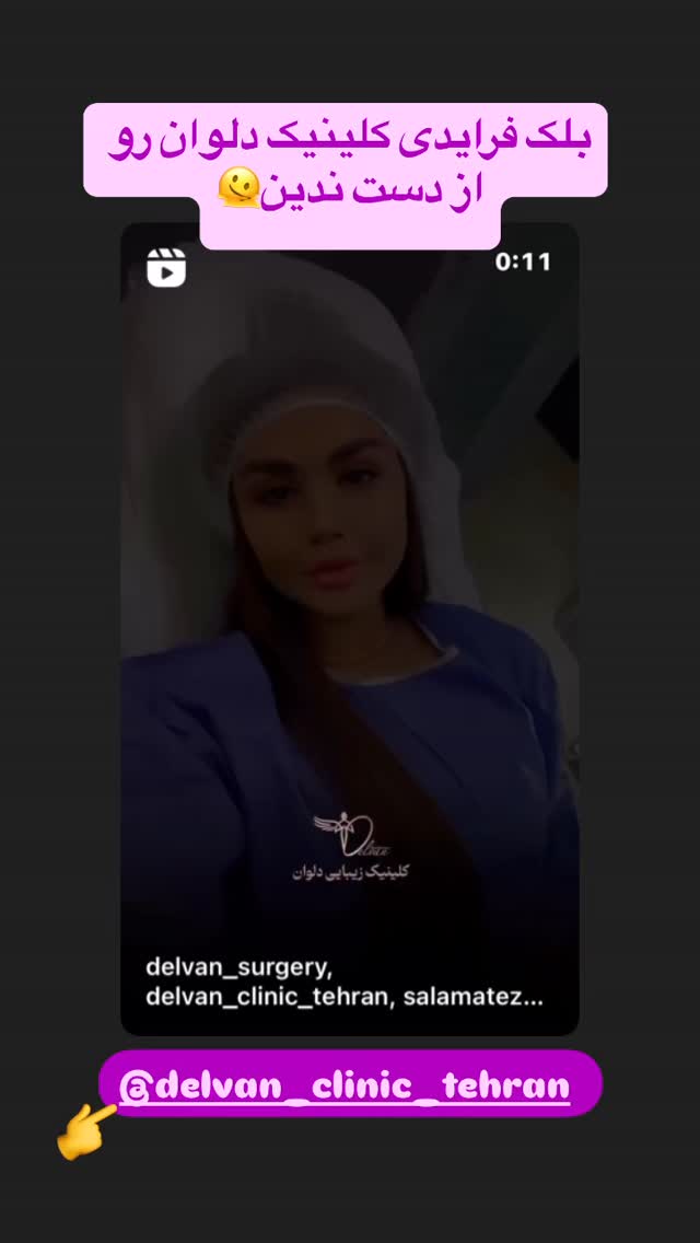  جدید ترین استوری اینستاگرام بفانیم Befunim