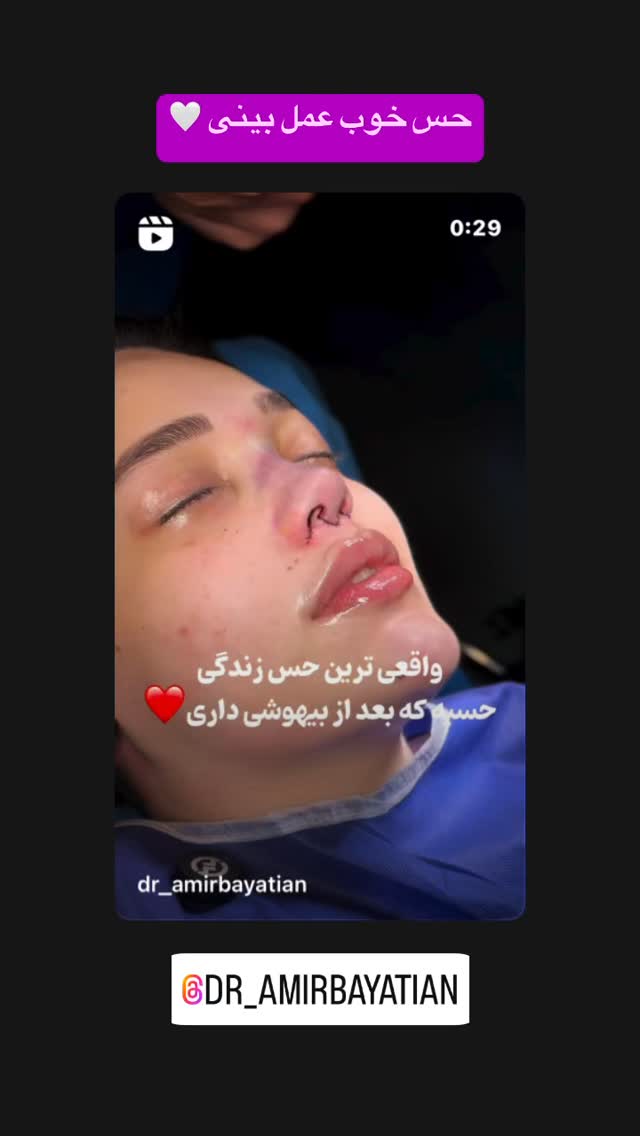  جدید ترین استوری اینستاگرام بفانیم Befunim